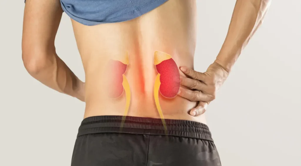 kidney stones treatment