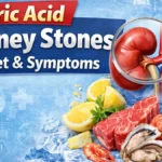 Uric acid kidney stones diet and symptoms guide 2026 showing foods to avoid like red meat, shellfish, soda and prevention tips with hydration and citrus