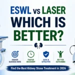 ESWL vs laser kidney stone treatment comparison infographic showing shock wave and laser surgery differences 2026