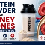Does protein powder increase kidney stone risk? Medical infographic showing whey protein, shaker bottle, and kidneys with stones.