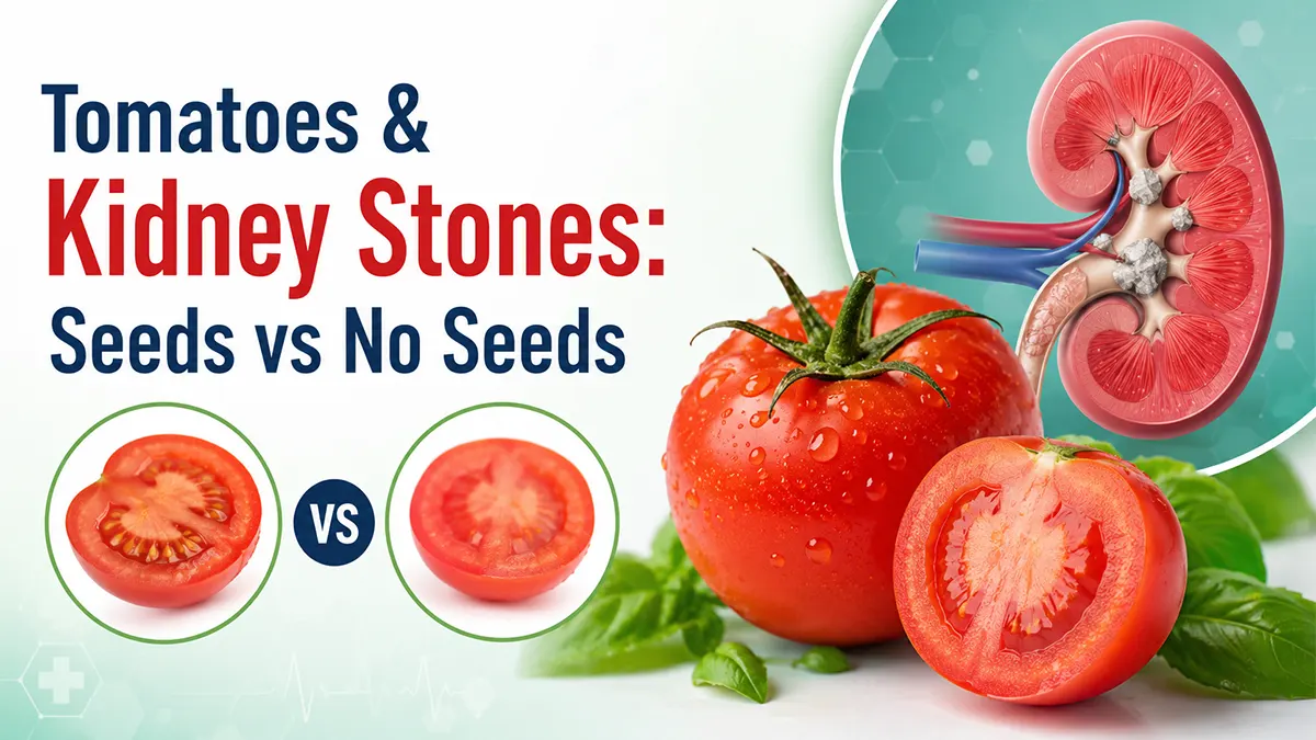 7 Facts: Are Tomatoes Bad for Kidney Stones?