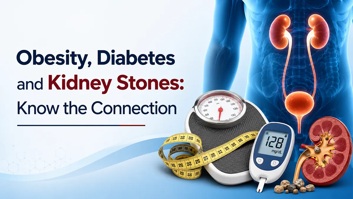 Obesity and kidney stones infographic showing the connection between type 2 diabetes, excess body weight, insulin resistance, and increased kidney stone risk.