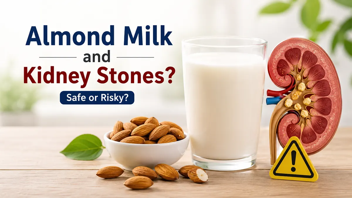 Is almond milk bad for kidney stones? Almond milk, almonds, and kidney illustration showing oxalate-related kidney stone risk.